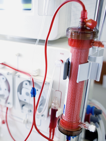 hemodialysis|혈액투석(인공신장실)